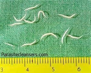 Pinworms